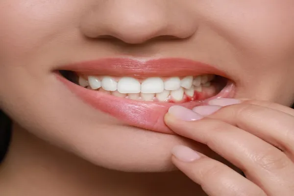 Gum Treatment