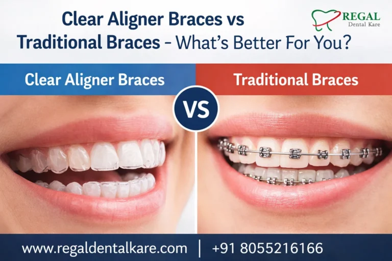 Clear Aligner Braces vs Traditional Braces – What’s Better For You?