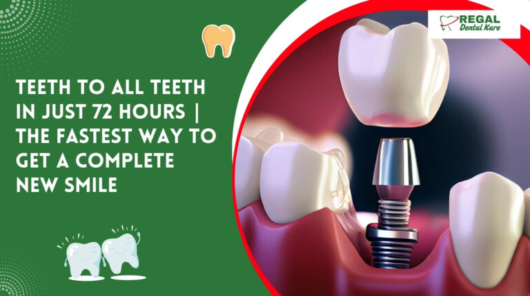 Teeth to All Teeth in Just 72 Hours | The Fastest Way to Get a Complete New Smile