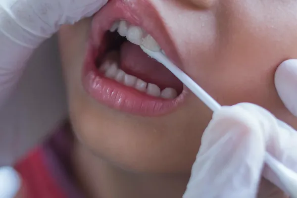 Pediatric Dentistry in Pune