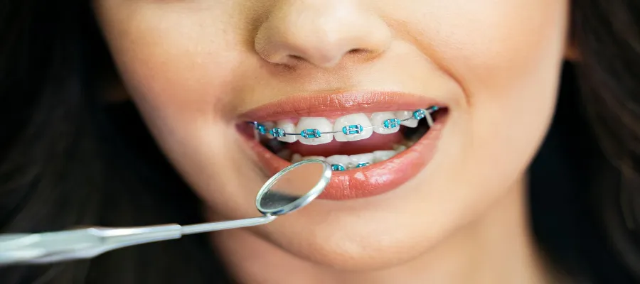 Orthodontic