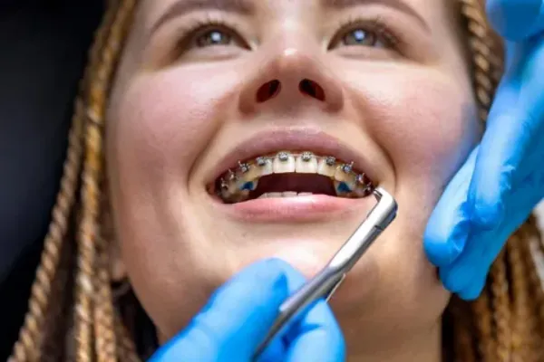 Orthodontic