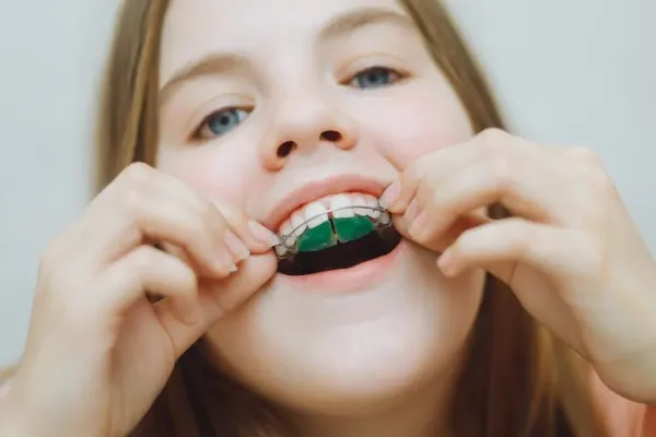 Bite Correction