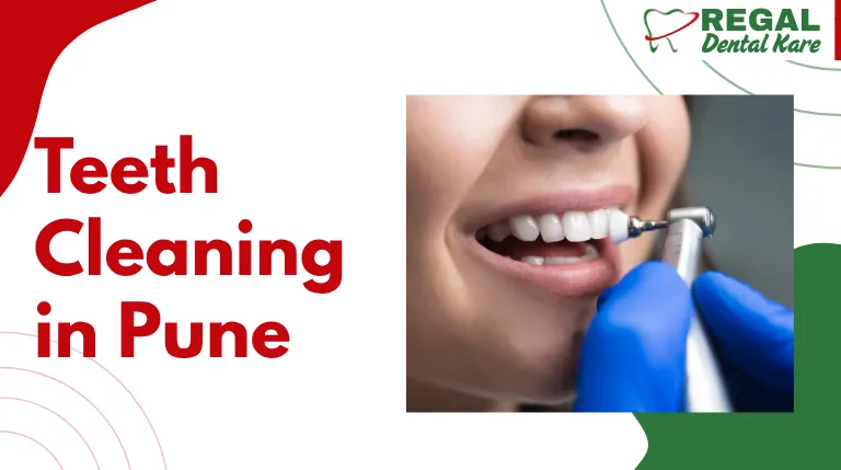 Teeth Cleaning