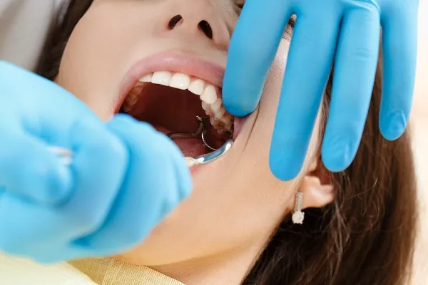 Wisdom Tooth Extraction in Pune