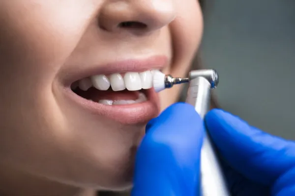 teeth cleaning