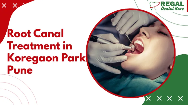 Root Canal Treatment in Koregaon Park Pune
