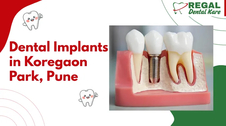 Dental Implants in Koregaon Park, Pune