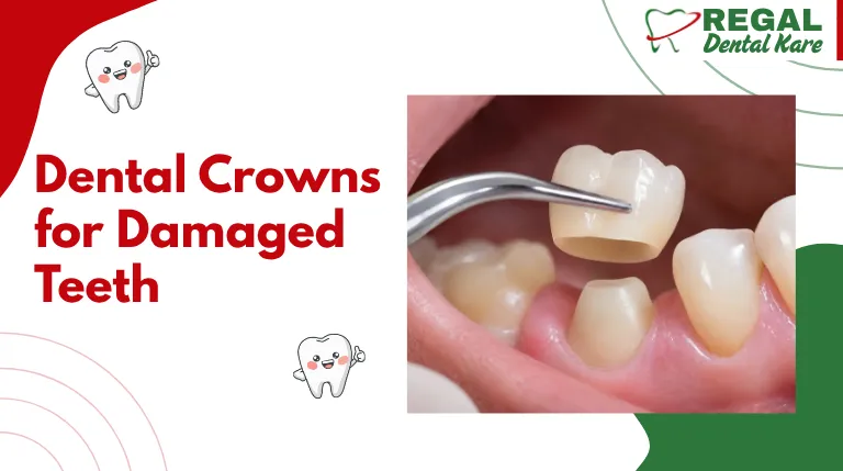 Dental Crown