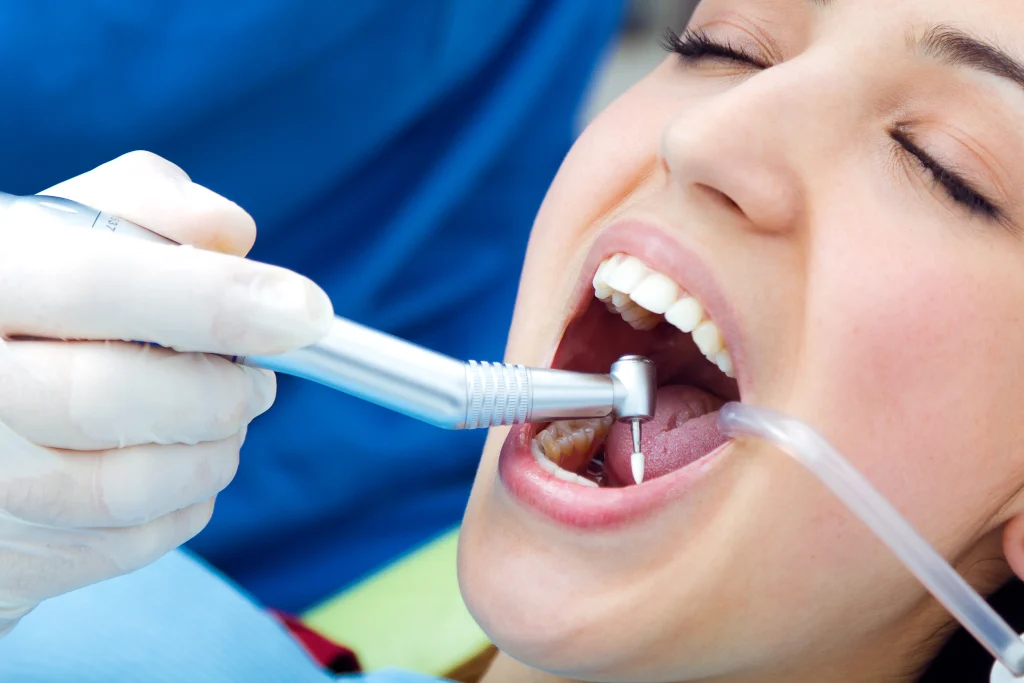 Root Canal Treatment in Koregaon Park Pune