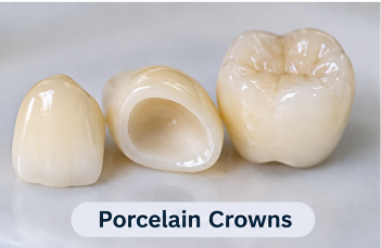 Porcelain Crowns